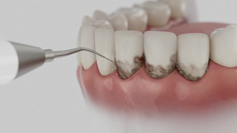 Trusted Dental Crowns And Bridges service in Fairmount, TN - Dentist Open Now